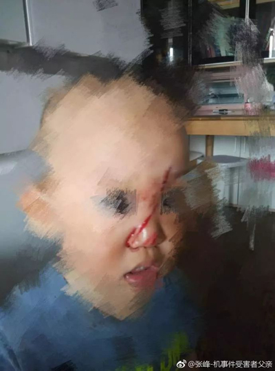 奔馳高管！在華傷人在先，拒賠在后，網友們怒了！