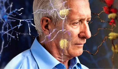 人工智能應用于臨床影像的數據分析能預測早期老年癡呆